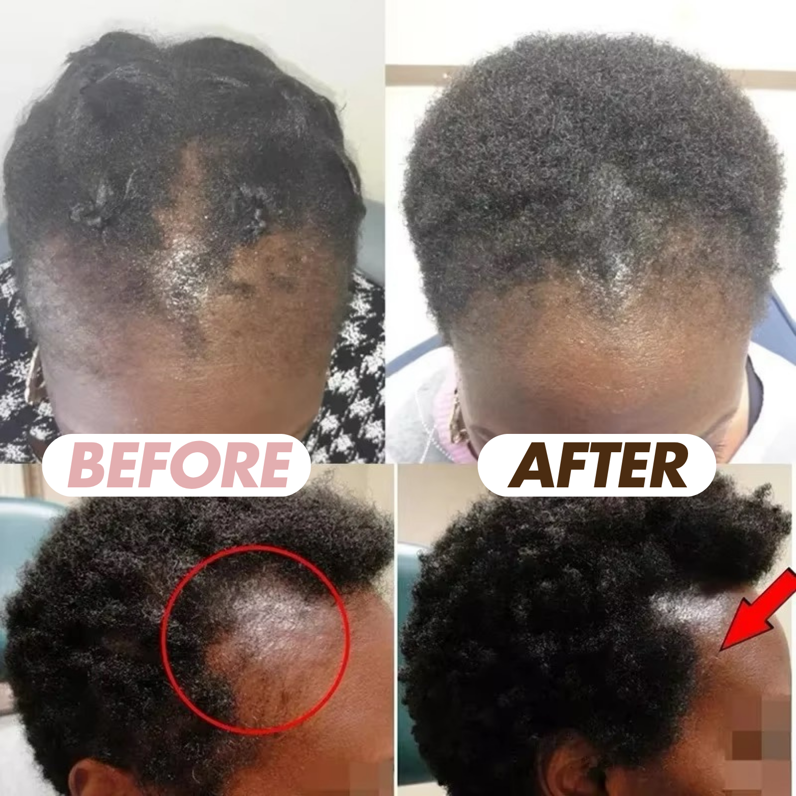 Curlic Activator Pro + Free Hair Growth Oil