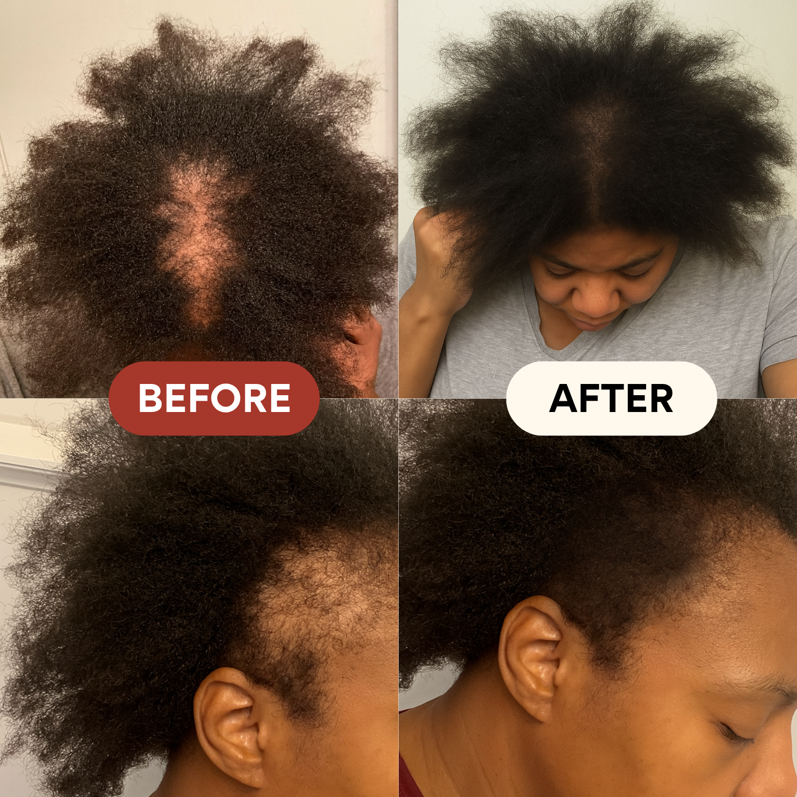 Curlic Activator Pro + FREE All-Natural Growth Oil + E-Book